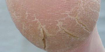 Nails & Beauty Magazine Hubs