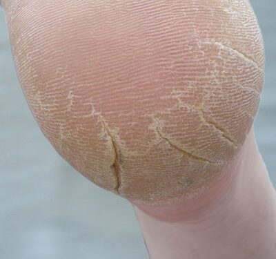 Nails & Beauty Magazine Hubs