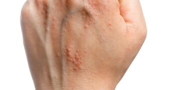 Nails & Beauty Magazine Hubs